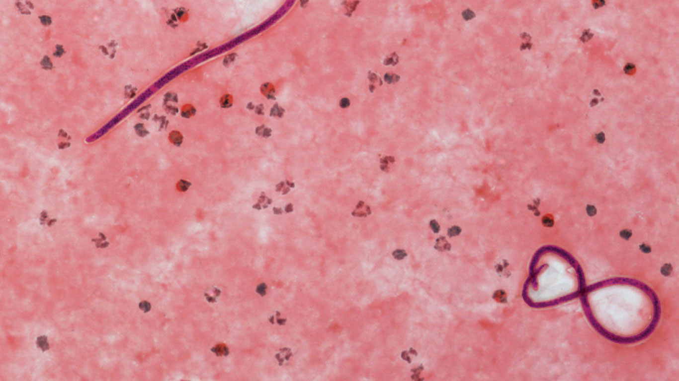 Würmer Zwischen Faszination und Ekel Welt der Wunder TV